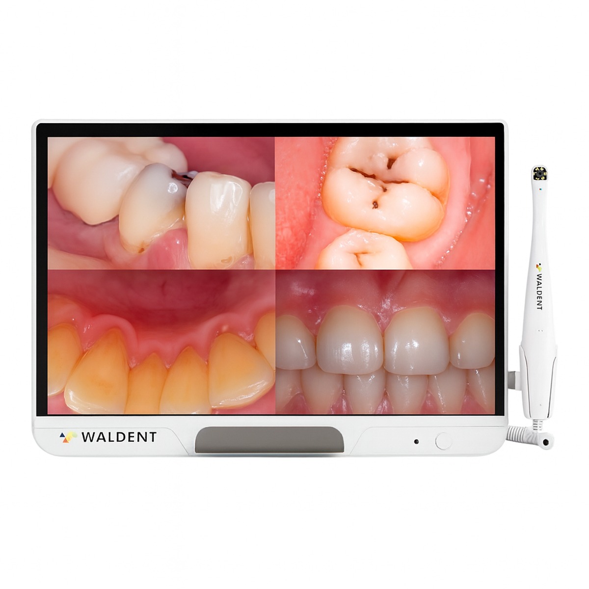 Waldent ProView Intraoral Camera System