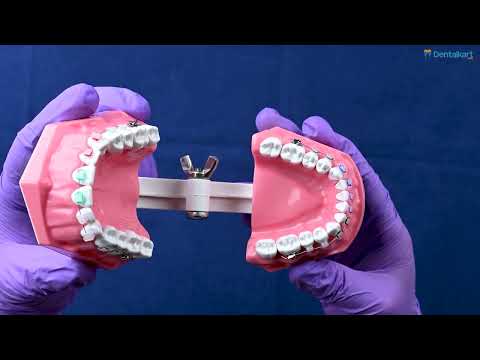 Identical Orthodontic Patient Education Model (Ceramic) - M3002	 - 2