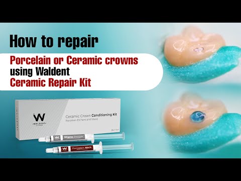 Waldent Ceramic Crown Conditioning Kit - 2
