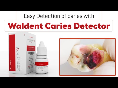 Waldent Caries Detector - 2